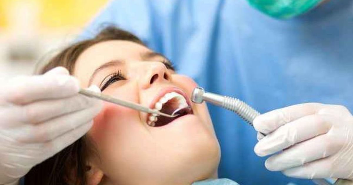 BPJS Kesehatan Bisa Dipakai untuk Bersihkan Karang Gigi, Ini Prosedur dan Syaratnya